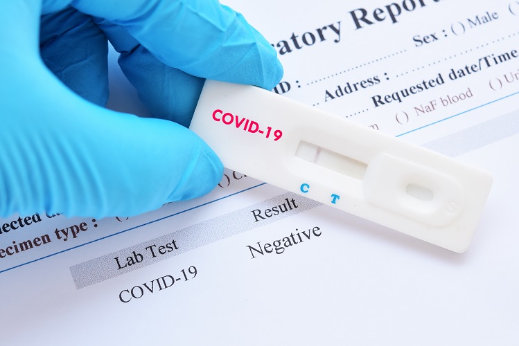 Qual teste de covid fazer? Entenda qual exame é indicado em cada um dos casos