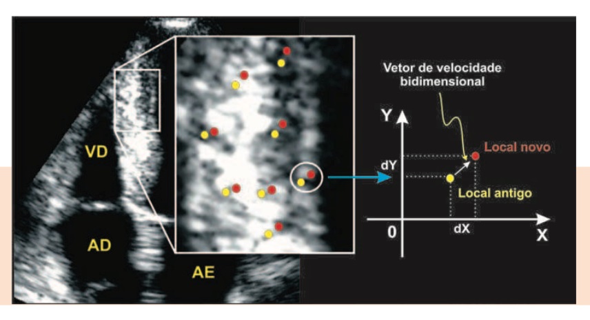 Ecocardiografia técnicas avançadas