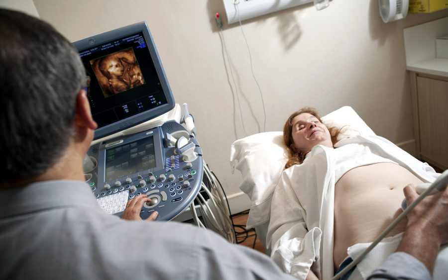 Ultrassom fetal impresso em 3D - Feto 3D